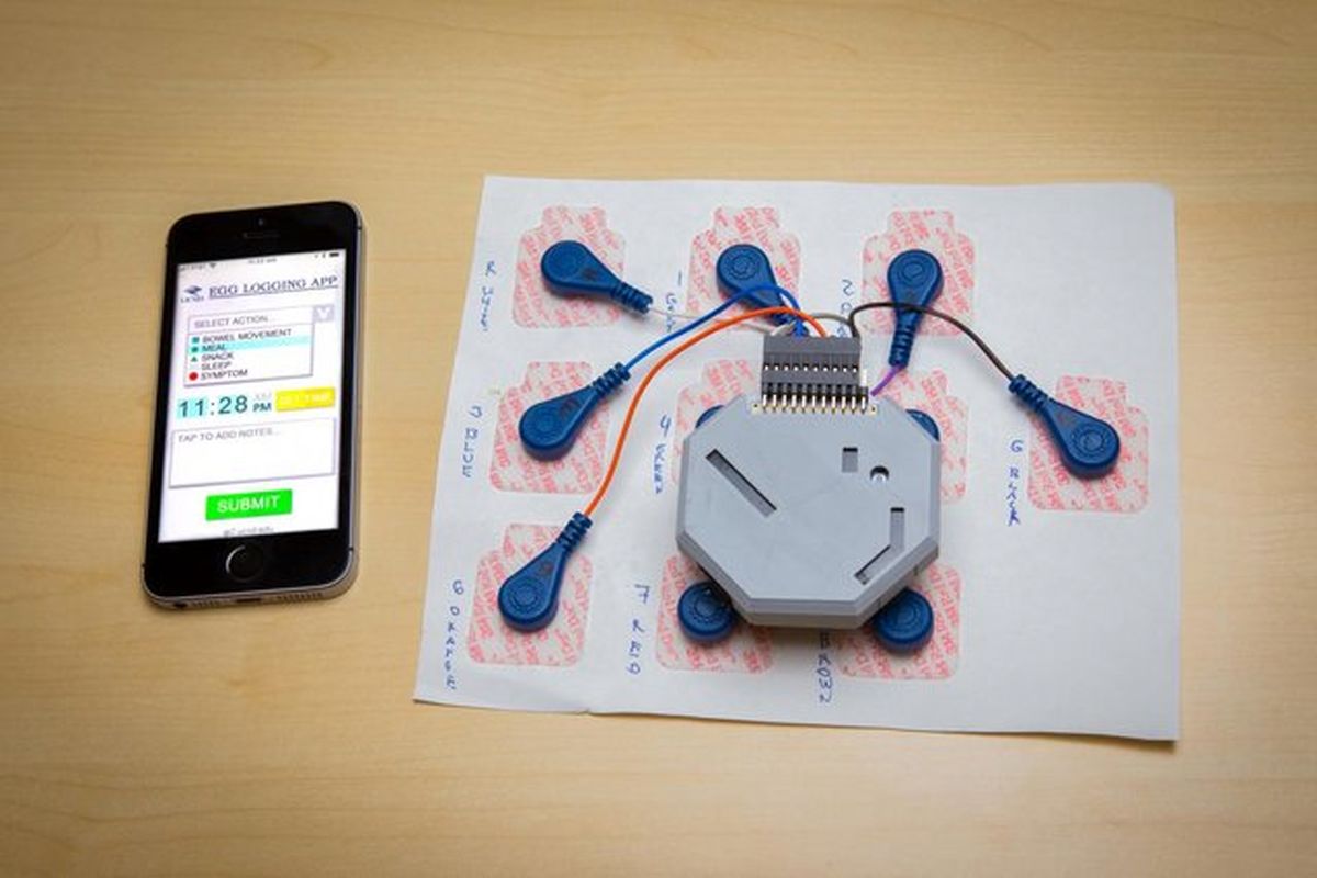 ابداع مانیتور پوشیدنی برای ردیابی علائم بیماری های گوارشی