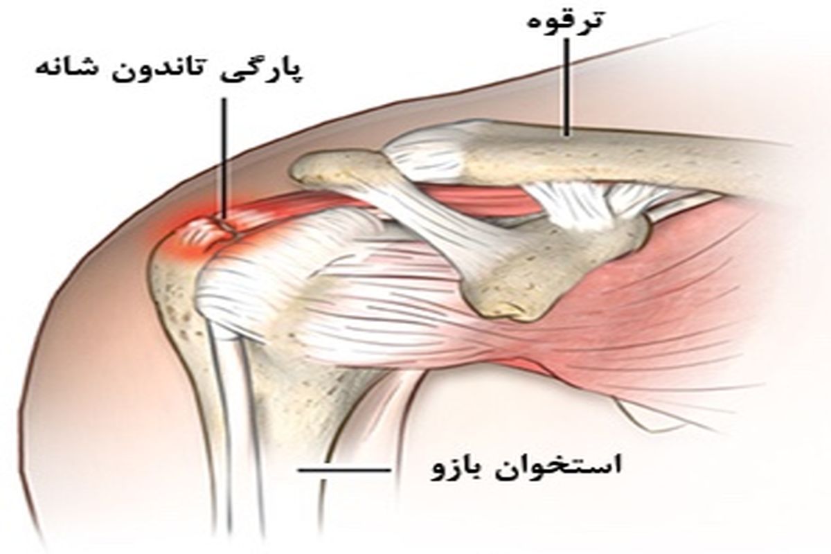 عواقب گرم نکردن قبل از ورزش