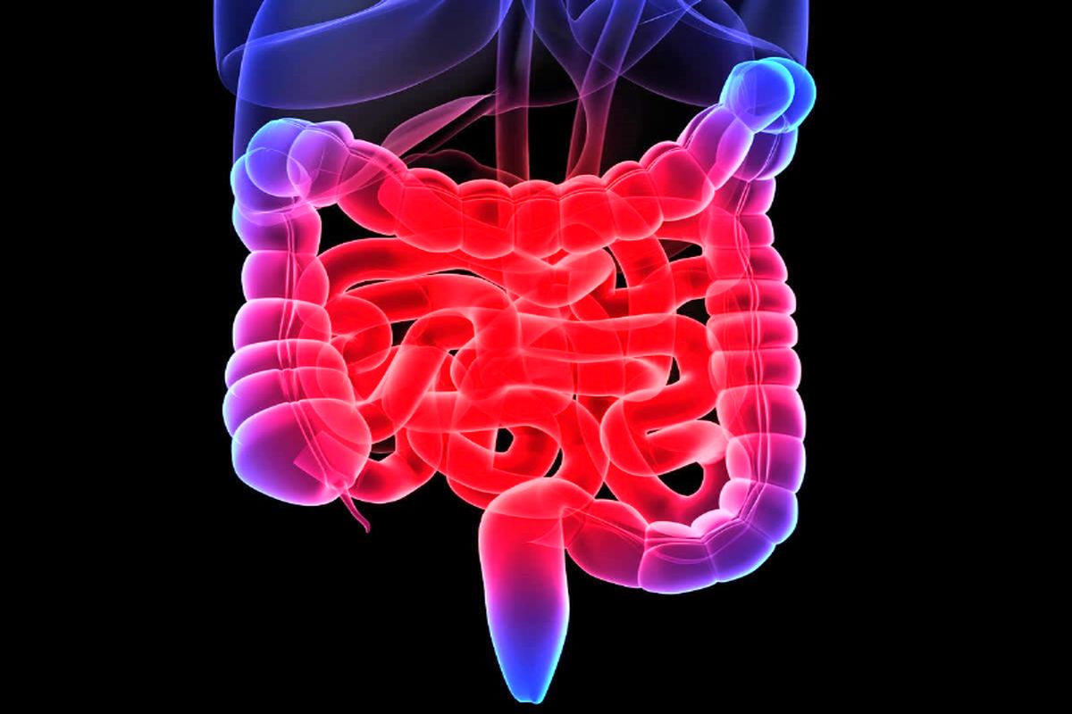 چند راهکار‌های خانگی برای درمان سندرم روده‌ی تحریک‌پذیر