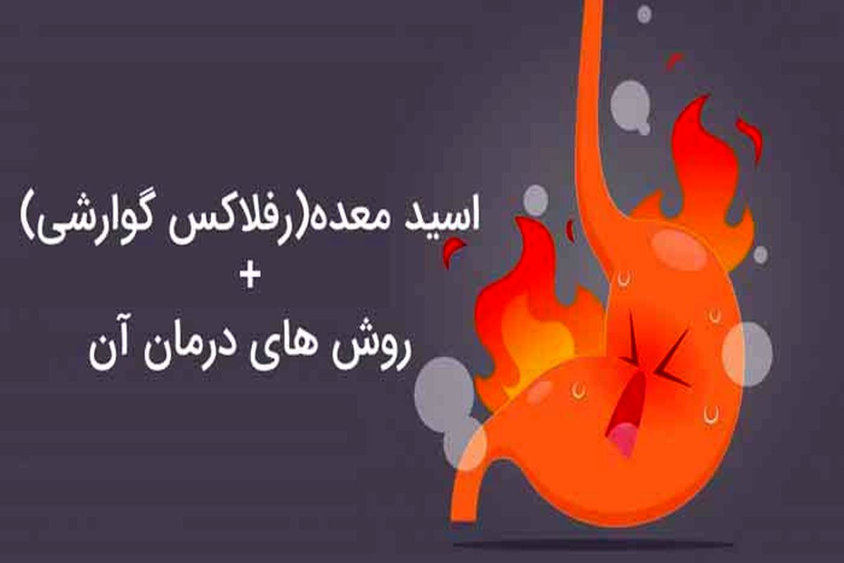 چرا اسید معده زیاد می شود؟ روشهای درمان خانگی