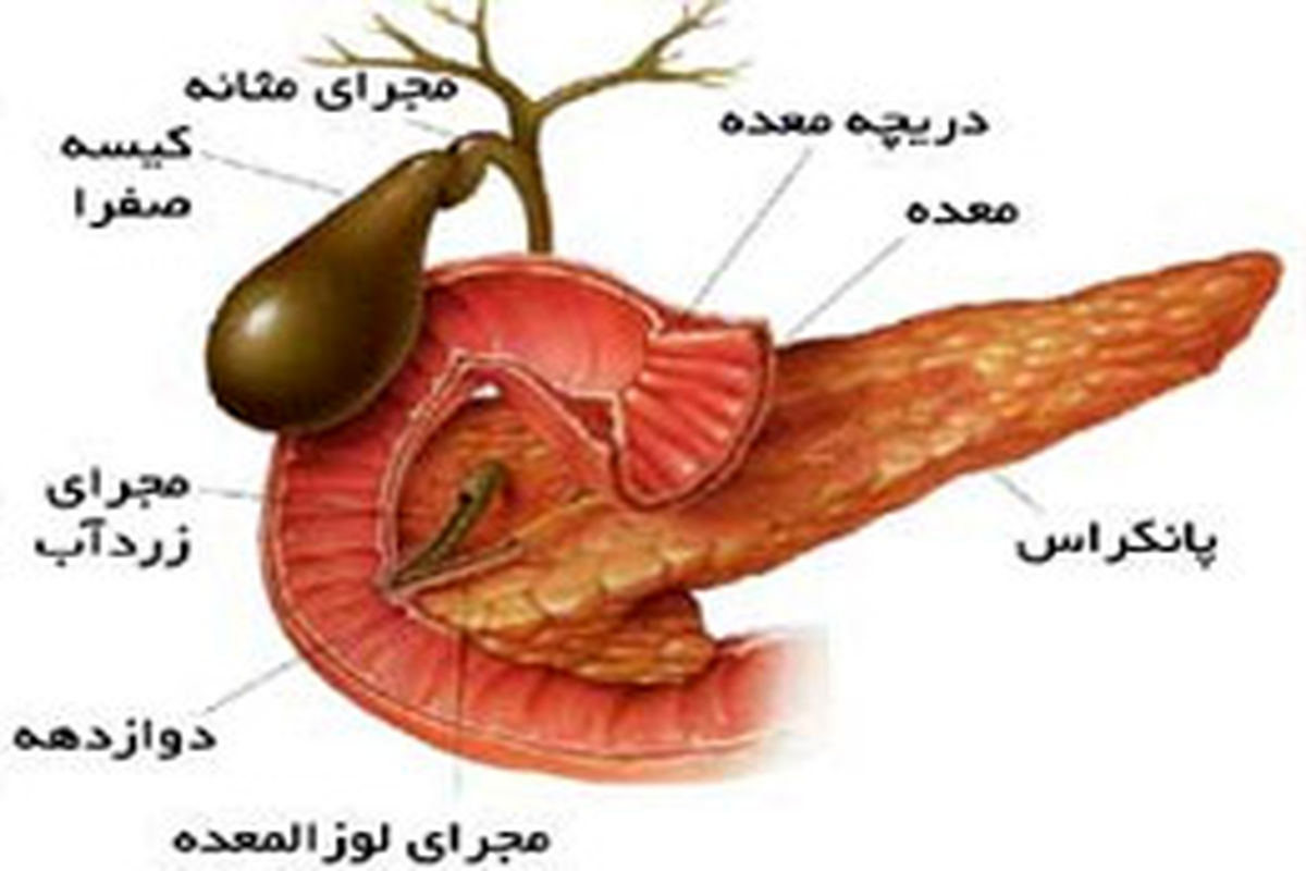 چگونگی درمان سنگ صفرا را بیاموزید