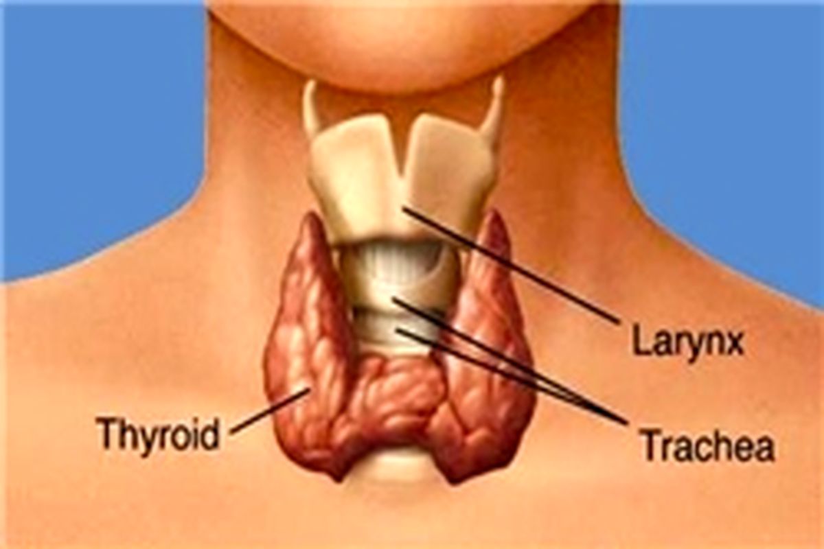 انجام جراحی تیروئید برای اولین بار در تایباد