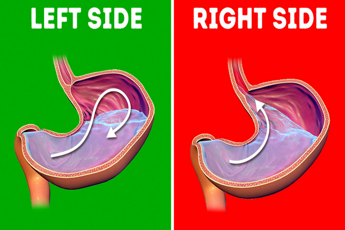 اگر دچار رفلاکس معده می شوید، این توصیه ها به شما کمک می کند