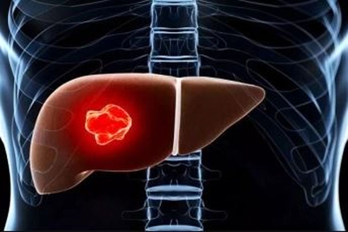 مسیرهای پیام‌رسان مشترک در تکوین کبد و سلول‌های سرطانی کبد