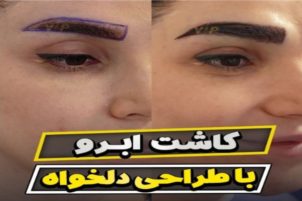 بهترین زمان برای کاشت ابرو چه زمانی است؟