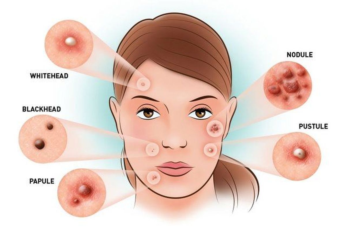 چرا نباید صورت را بیش از حد شست؟