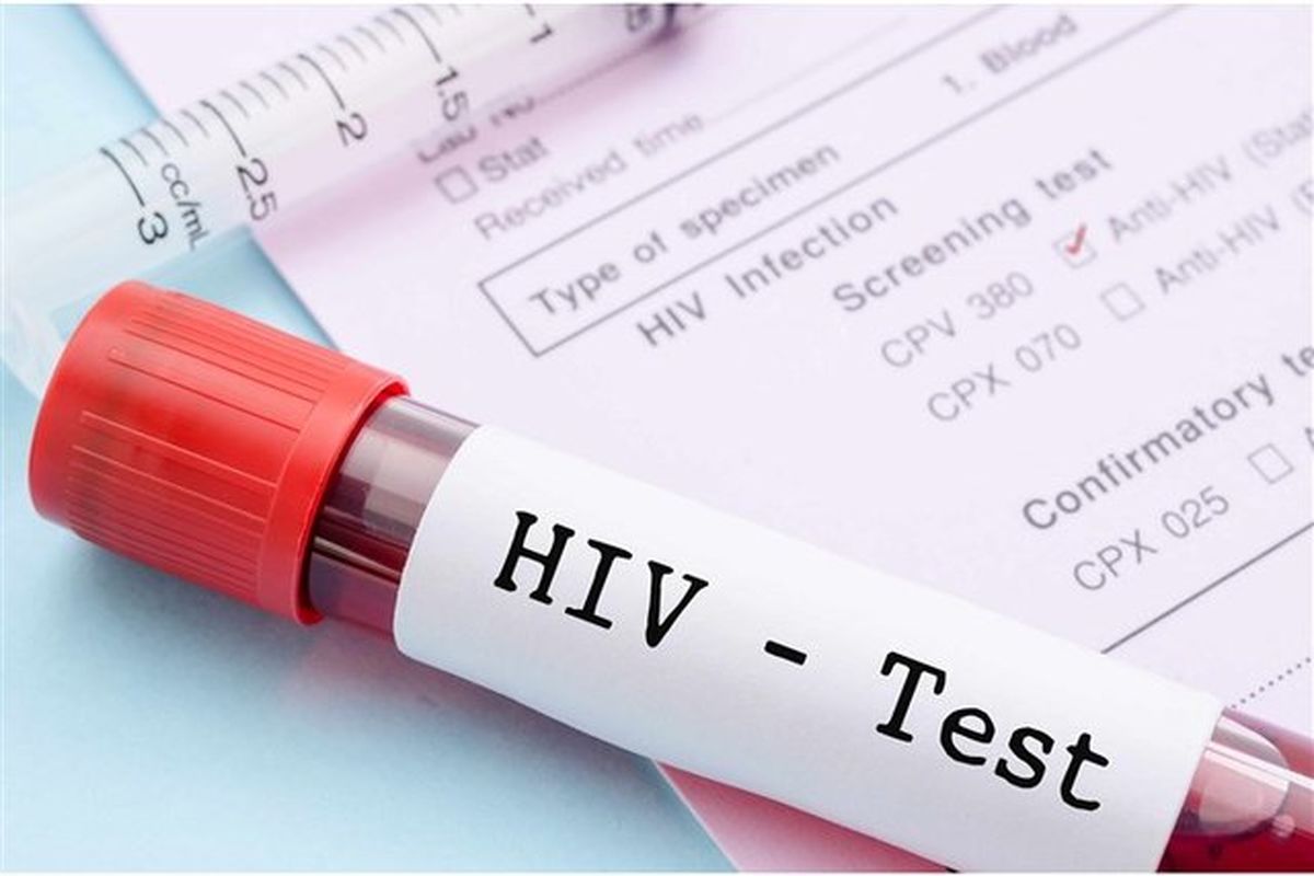 برای تشخیص محرمانه و رایگان HIV به کجا باید مراجعه کرد؟