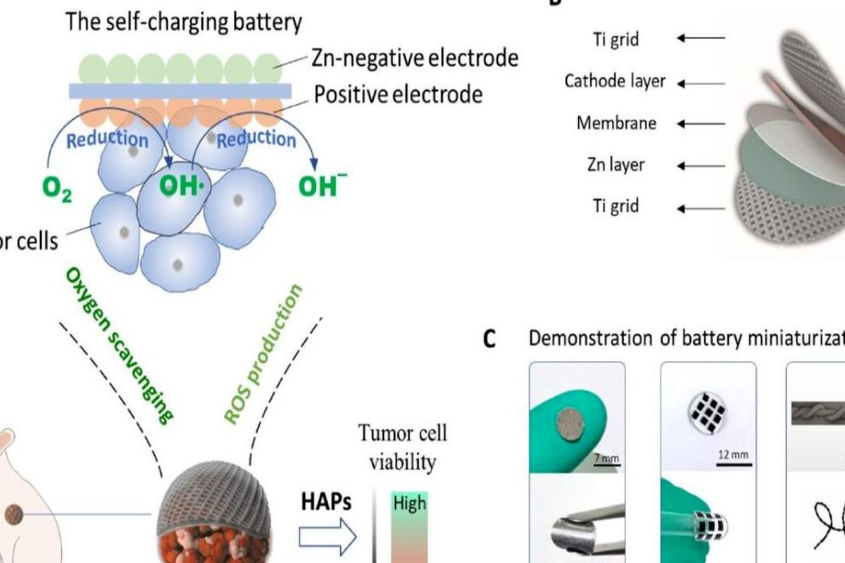 ساخت باتری قابل کاشت برای کمک به از بین بردن تومور‌های سرطانی